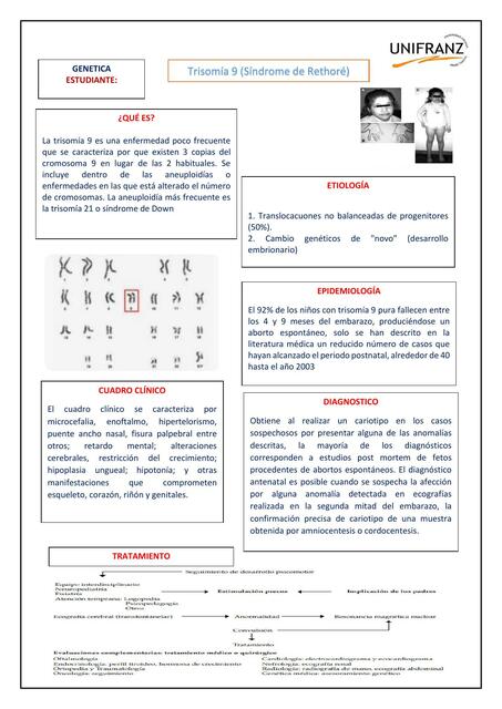 Trisomía 9 (Síndrome de Rethoré)