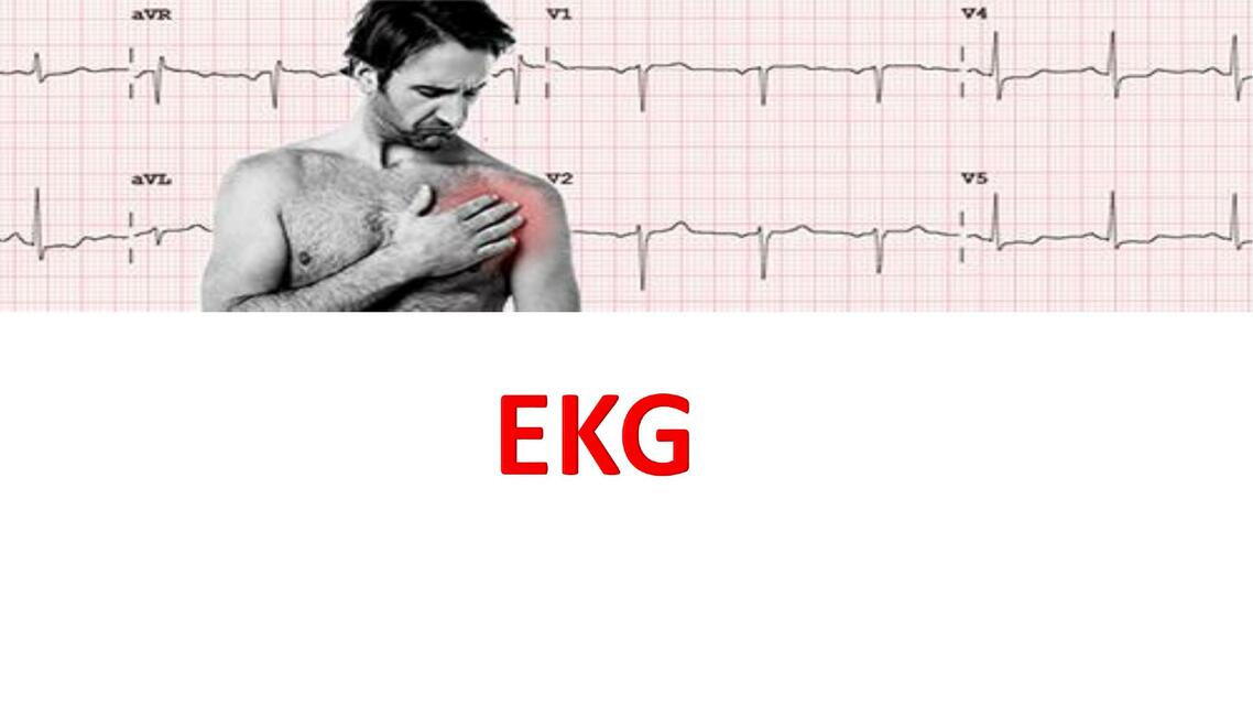 Ekg