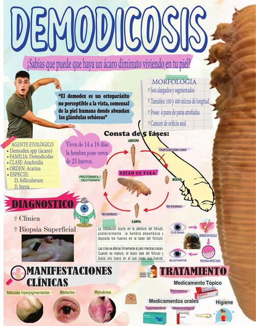 Demodicosis