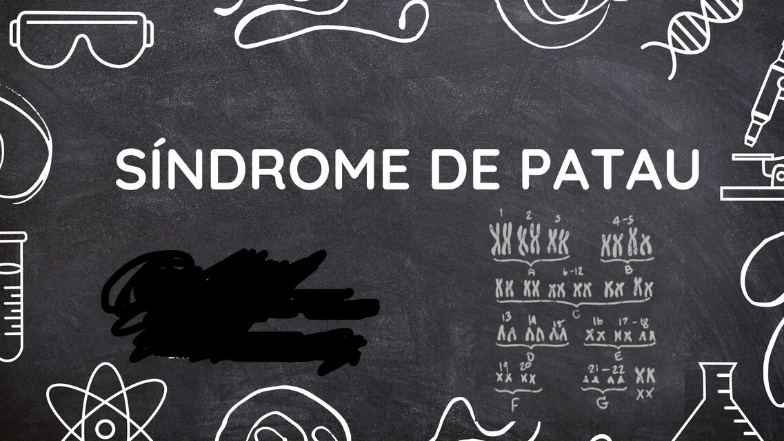 Síndrome de Patau