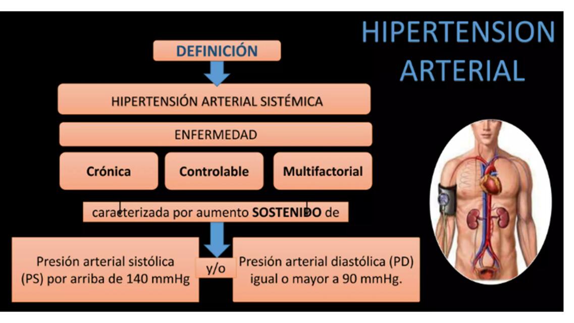 Hipertension Arterial definicion | Alxnsx s | uDocz