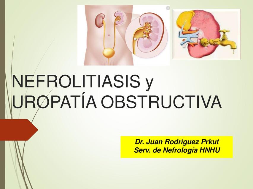 Nefrolitiasis y uropatía obstructiva 