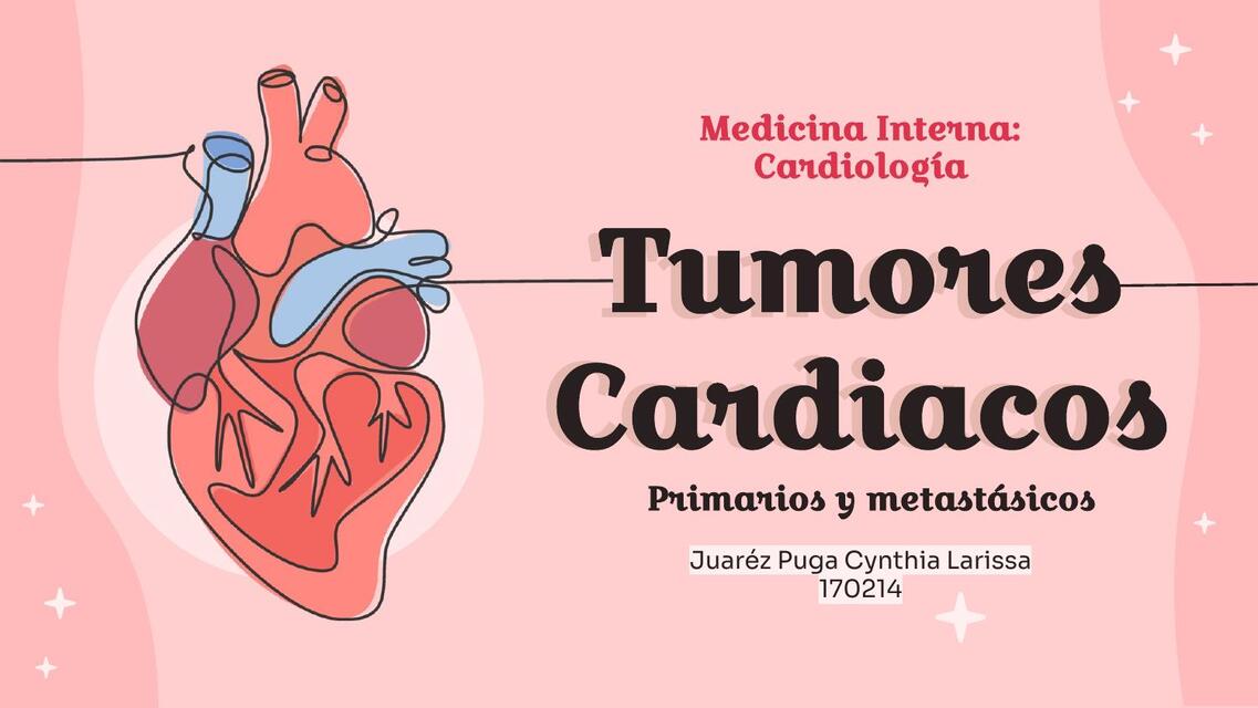 Tumores Cardiacos 