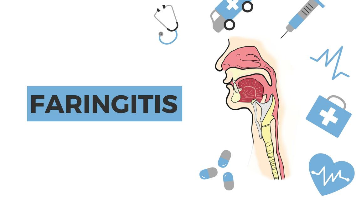 Faringitis