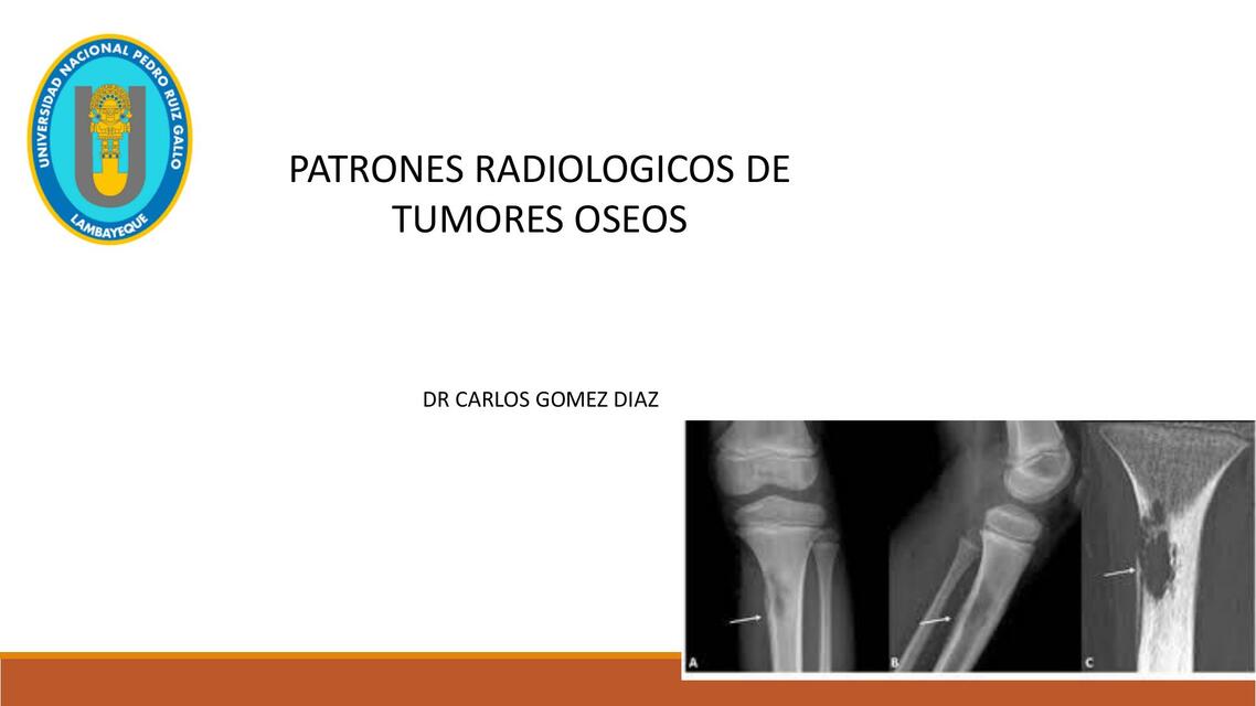 Patrones radiologicos de tumores óseos 