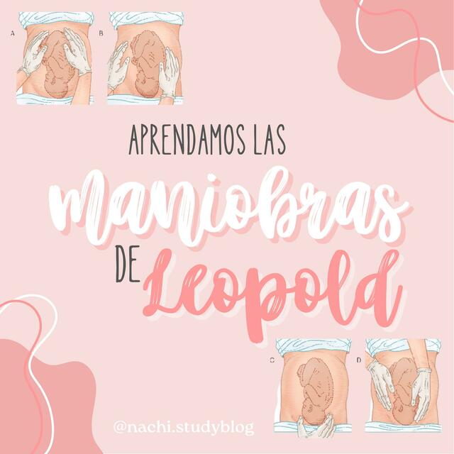 Maniobras de Leopold