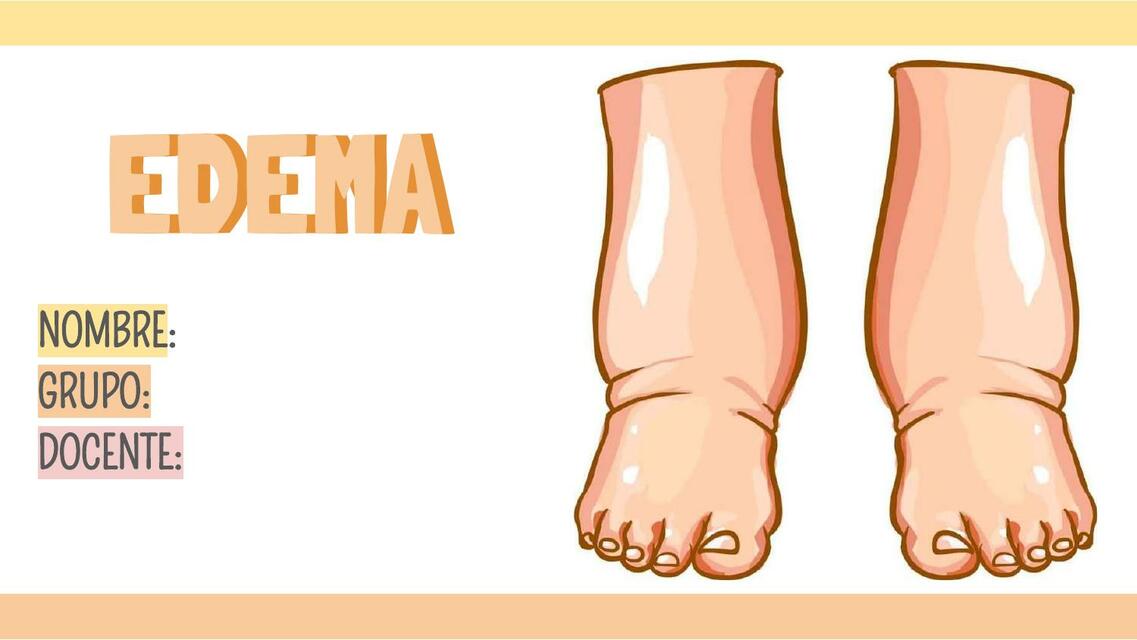 EDEMA