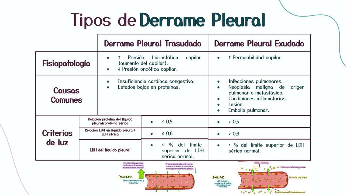 DERRAME PLEURAL