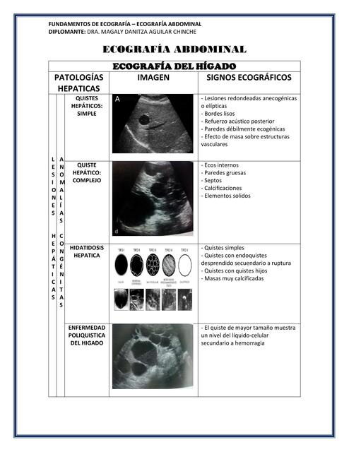 Ecografía abdominal 