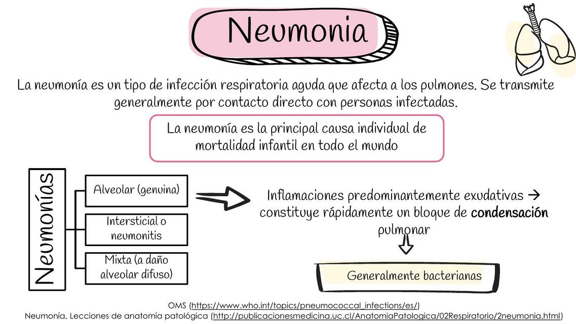 Neumonía bacteriana