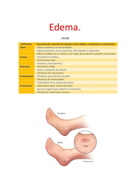 Edema | José Fabricio Montaño Céspedes | uDocz