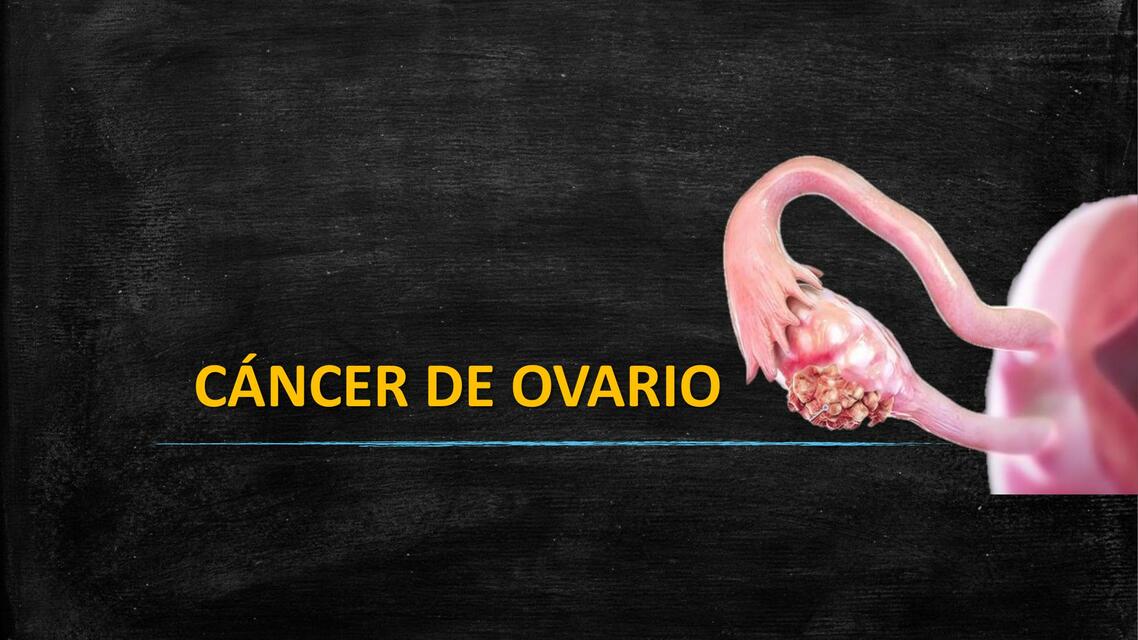 Cáncer de ovario