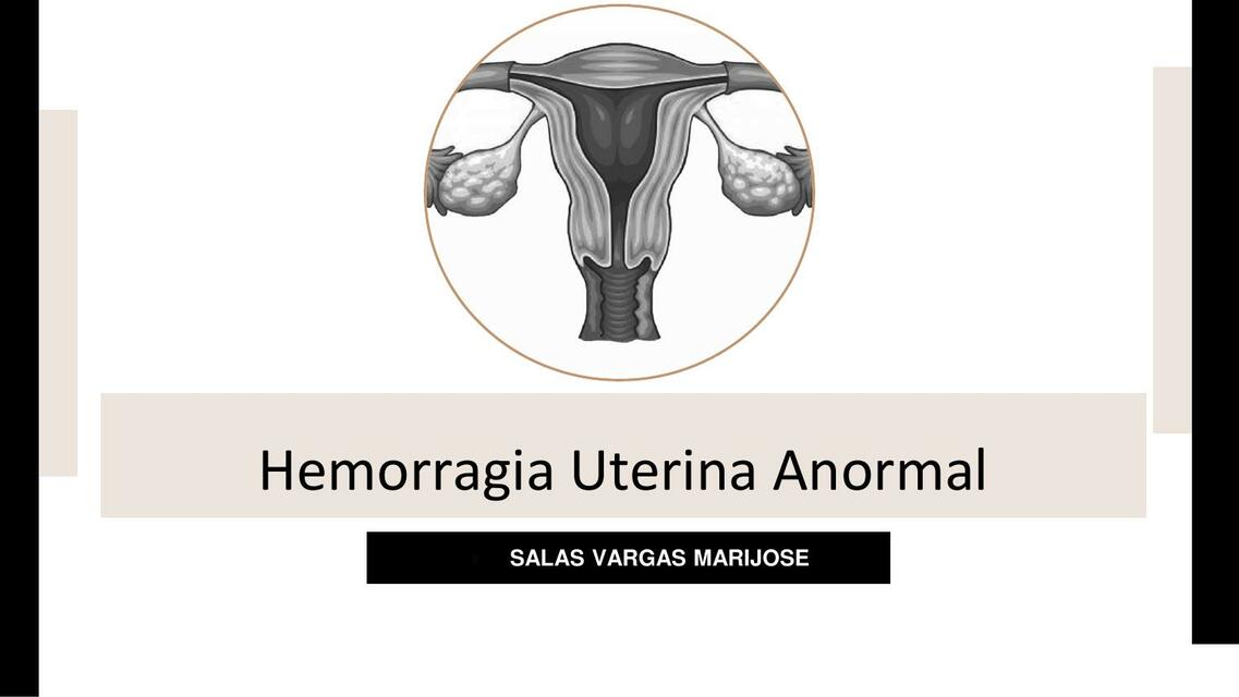 Hemorragia Uterina Anormal