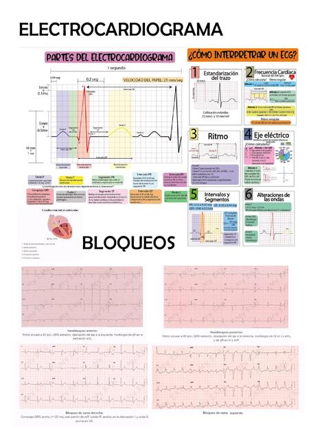 Tipos de electrocardiograma 