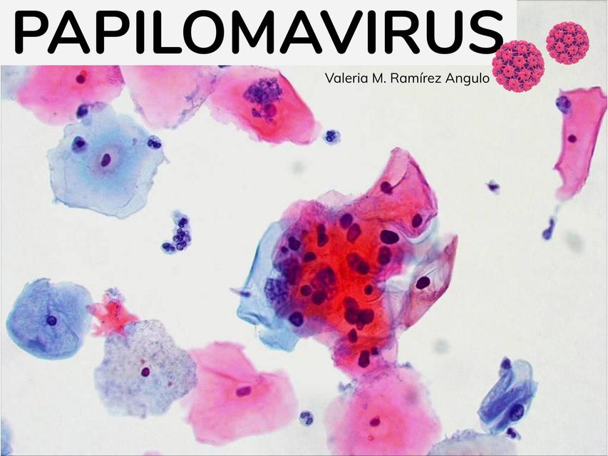 VPH Virus del Papiloma Humano