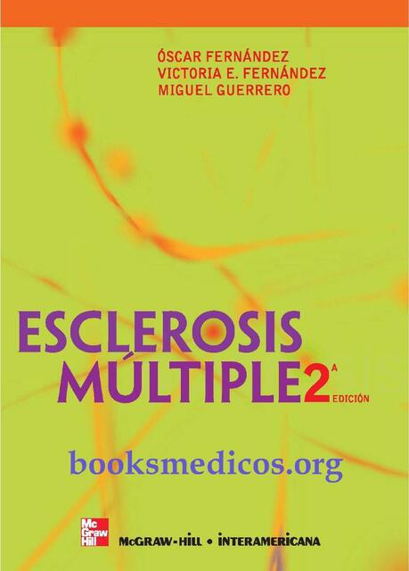 Esclerosis múltiple 