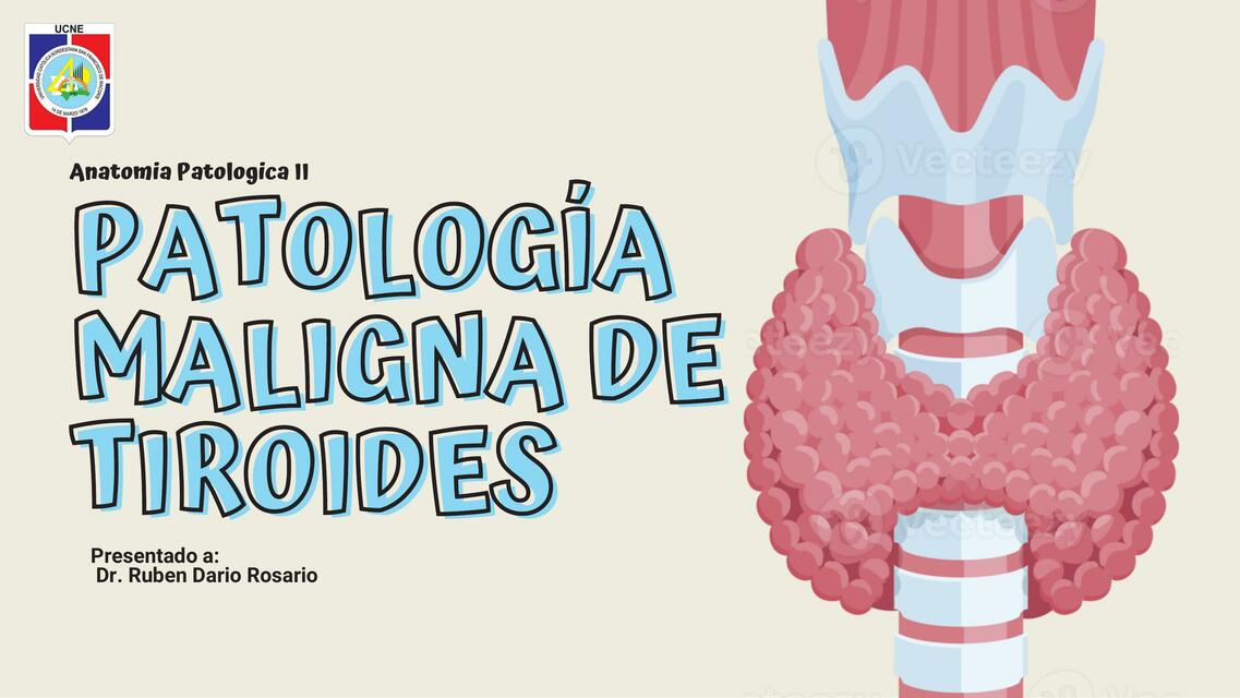 Patología Maligna de Tiroides 