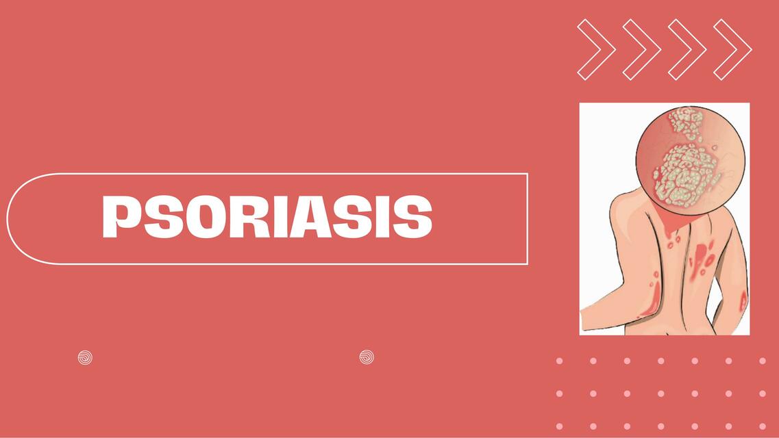 PSORIASIS