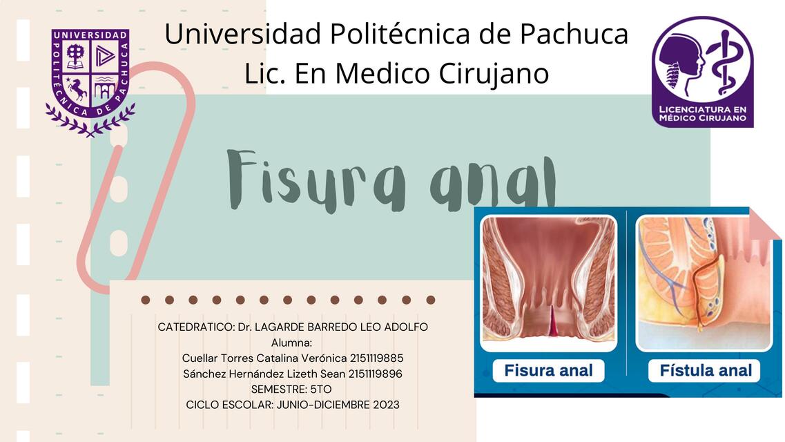 Fistula y fisura anal