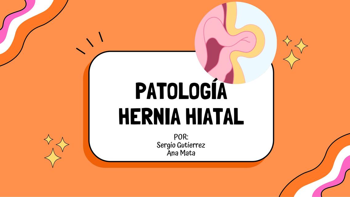 Presentación hernia hiatal