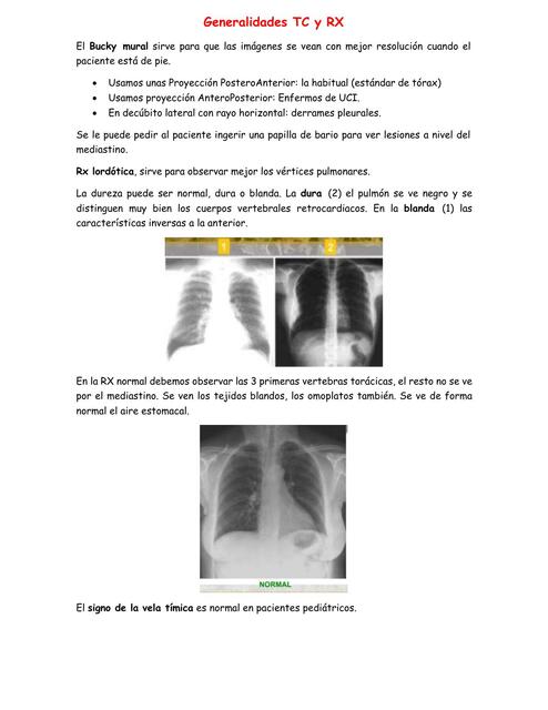 Generalidades TC y RX 