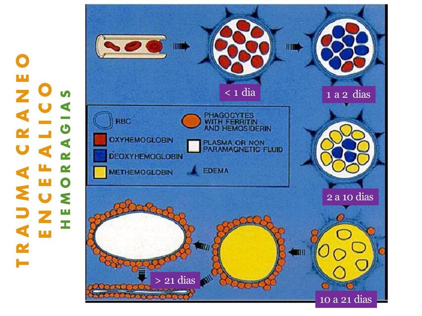Trauma cráneo encefálico 