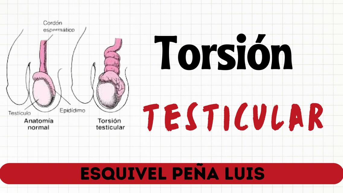 Torsión testicular Luis Esquivel Peña uDocz
