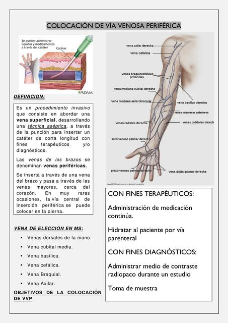 Vía venosa periférica