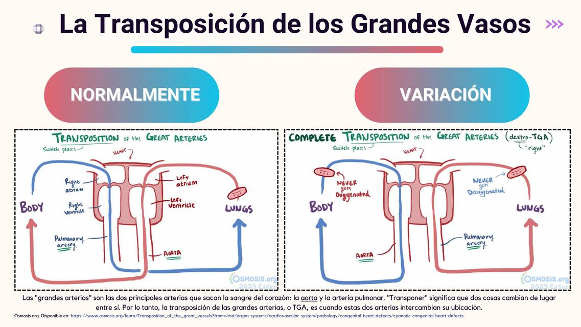 La Transposición de los Grandes Vasos