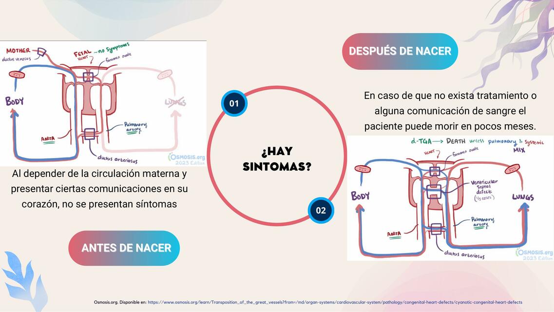 Transposición de los Grandes Vasos 2