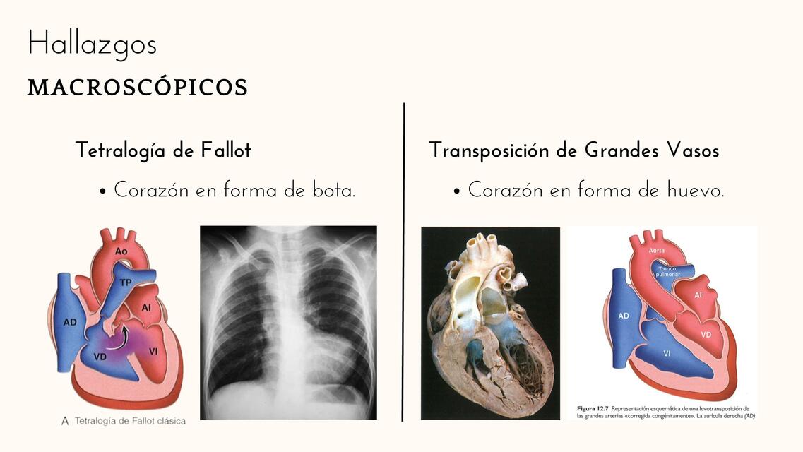 Corto circuito Macro