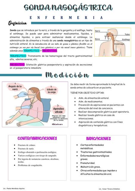 sondaje nasogástrico en adulto 