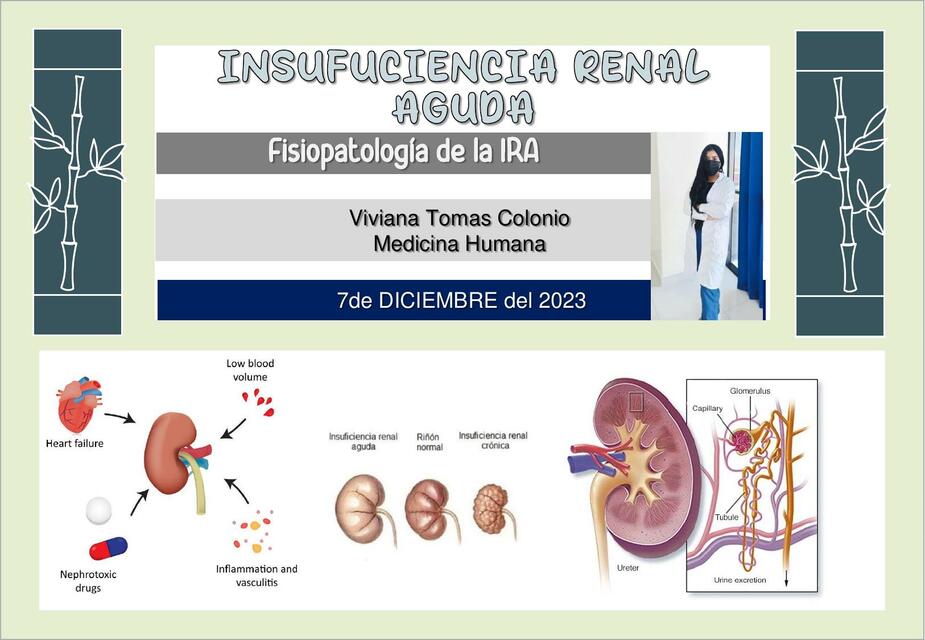 FISIOPATOLOGIA INSUFICIENCIA RENAL AGUDA