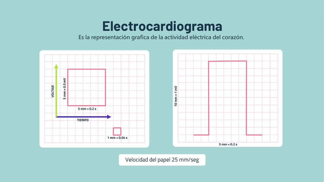 ELECTROCARDIOGRAMA EXPOSICIÓN