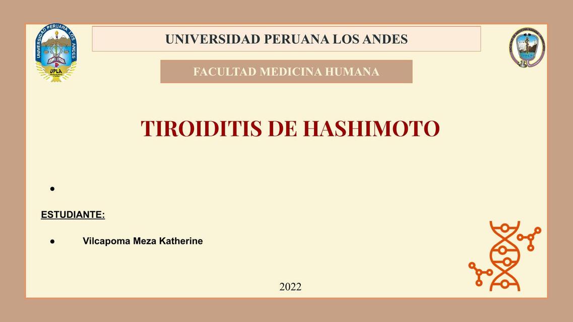 tiroiditis de Hashimoto