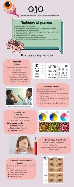 Infografía de Ojo