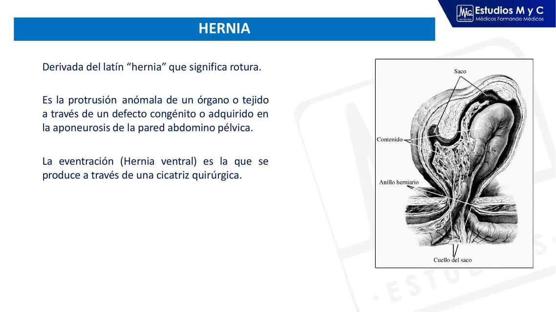 HERNIAS EXPO 