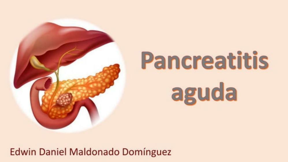 Pancreatitis aguda 