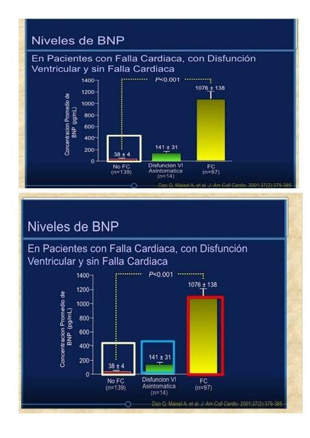 Niveles de BNP 