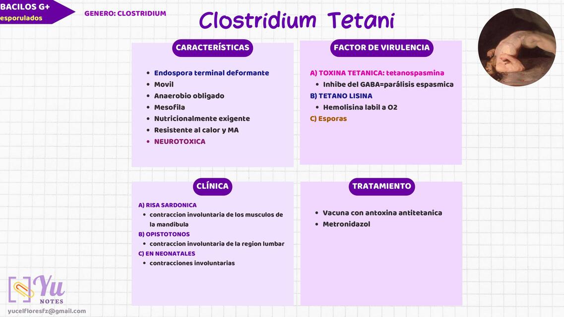 Clostridium tetani