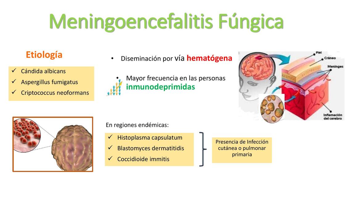 Meningoencefalitis fúngica 