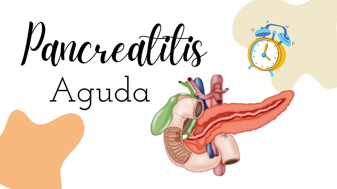 Pancreatitis aguda 