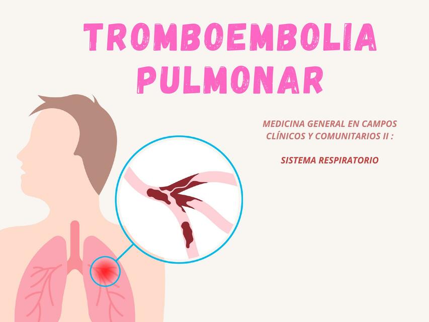 Trombosis pulmonar