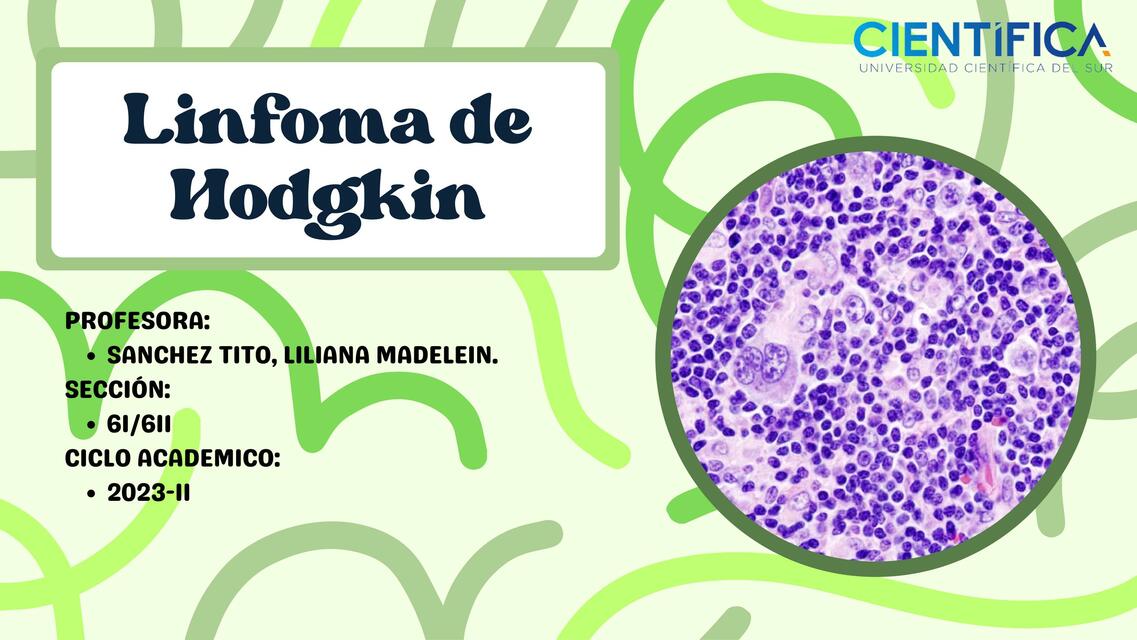 Linfoma de Hodgkin