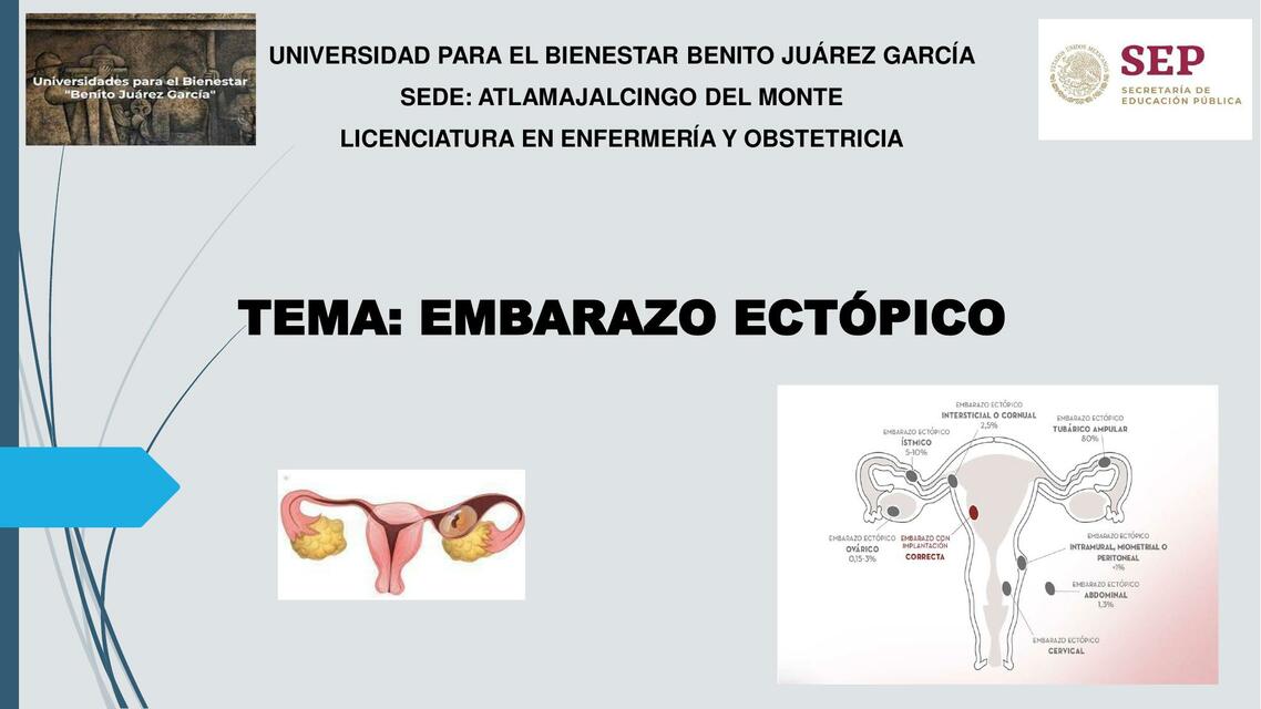 Embarazo ectopico