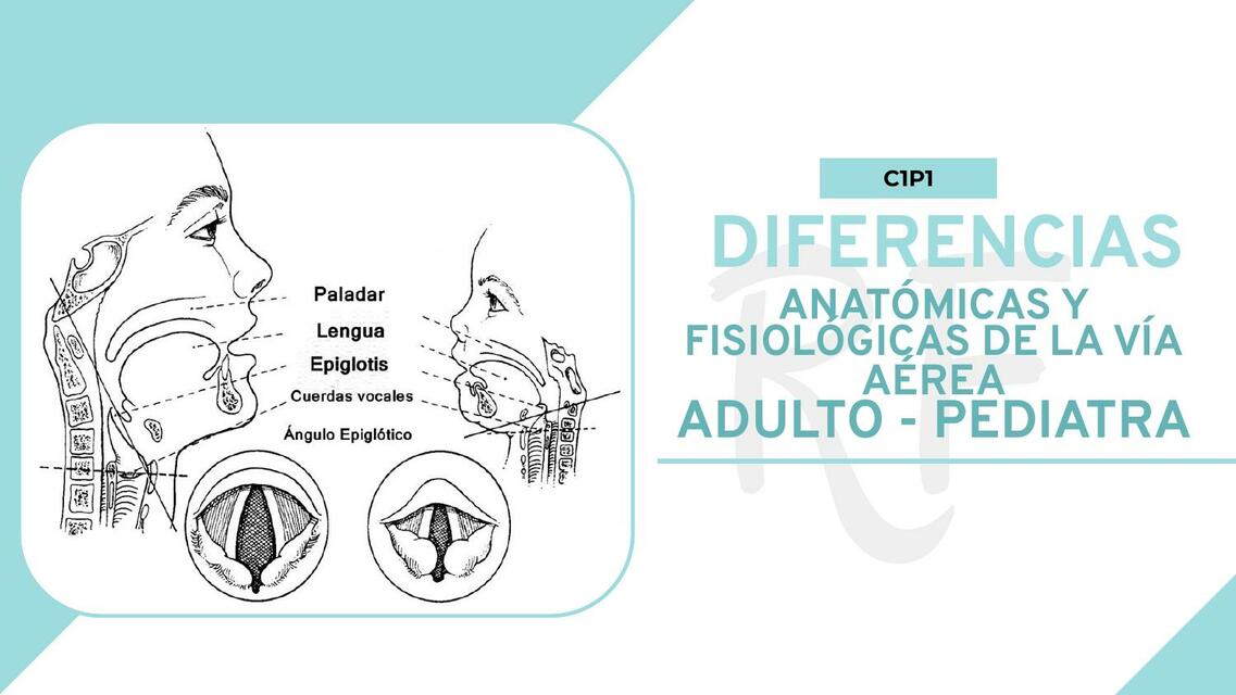 DIFERENCIAS DE LA VÍA AÉREA ENTRE ADULTO PEDIATRA