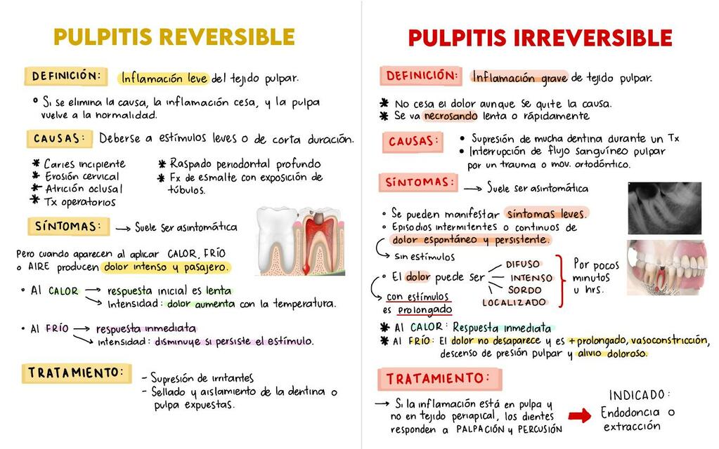 Patologías Pulpares y Periapicales en Endodoncia