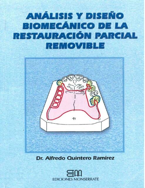 Análisis y diseño biomecánico de la restauración parcial removible 