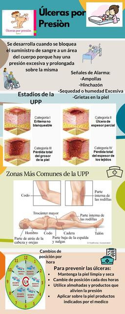 Ulceras por presión