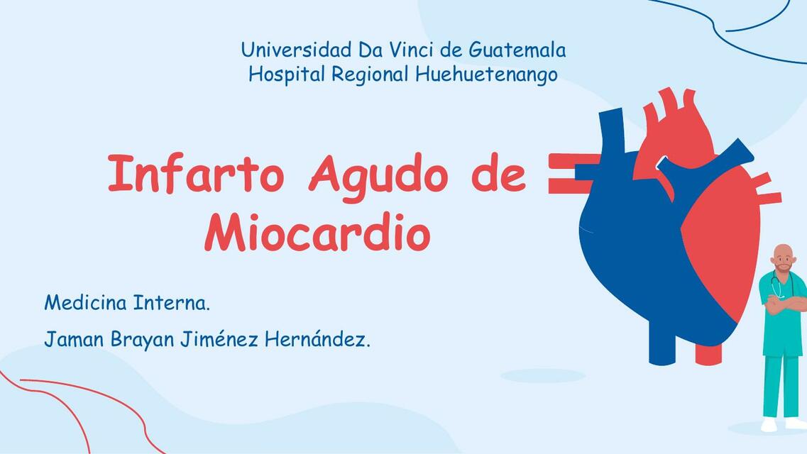 Infarto Agudo de Miocardio